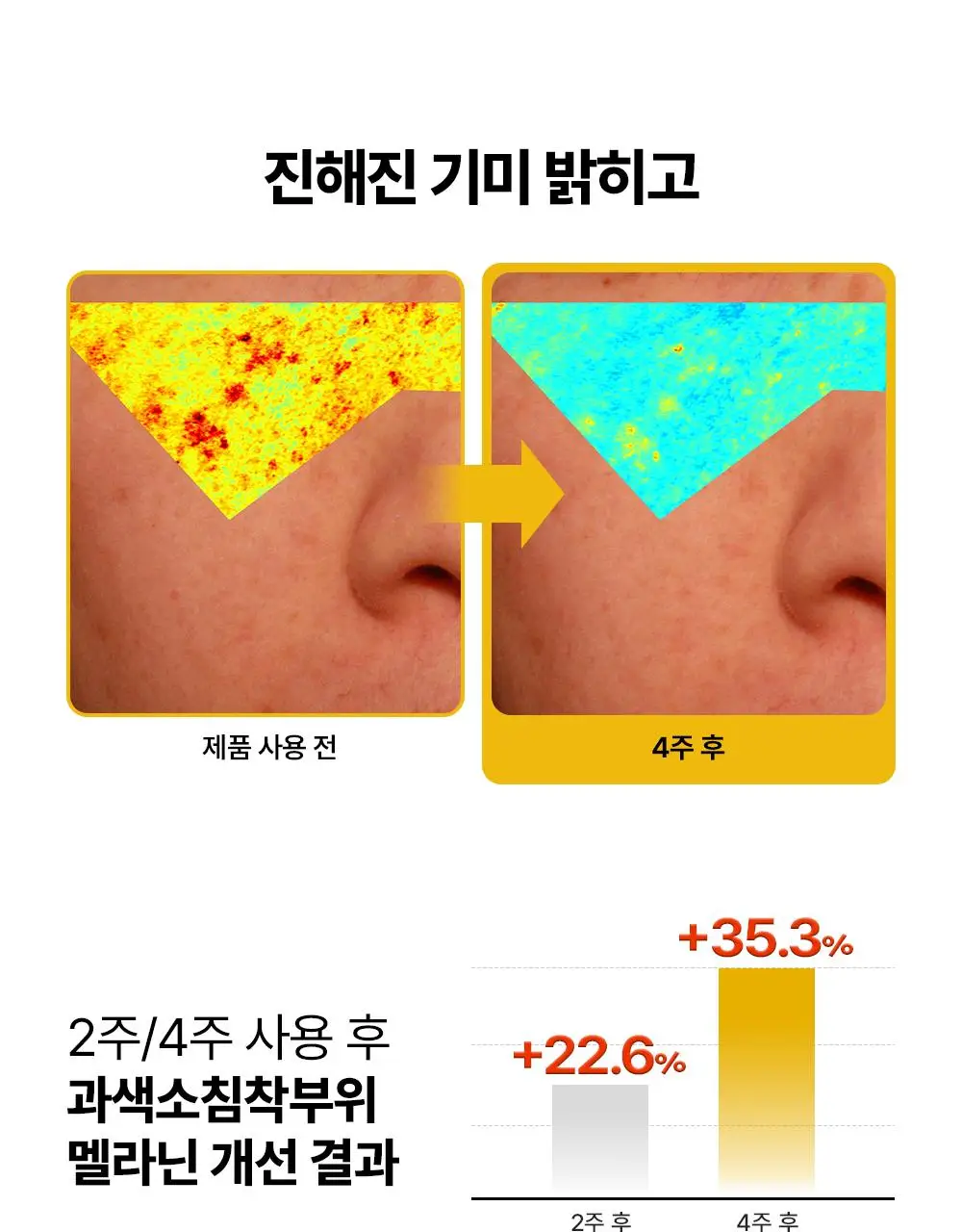 [잡티저격/TXA] 퍼셀 80억/mL 글루타치온 TXA 캡슐 크림 80ml 상세페이지 10